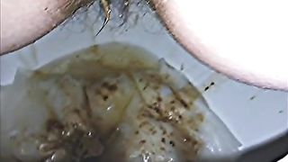 Diarheea from my wife