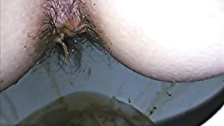 Diarheea from my wife