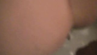 Shit on my husbands hand