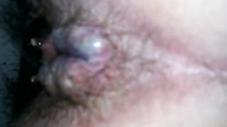 Close up of an asshole after pooping