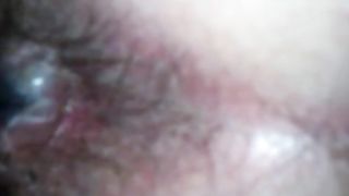 Close up of an asshole after pooping