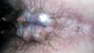 Close up of an asshole after pooping