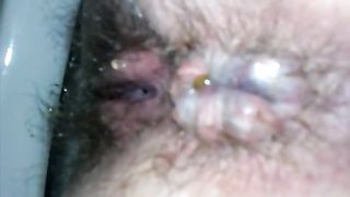 Close up of an asshole after pooping