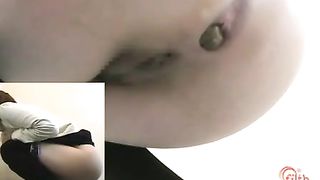 Reverse poop