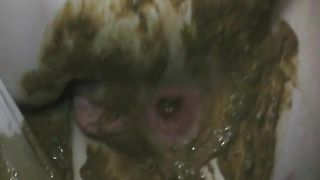 Pooping and smearing