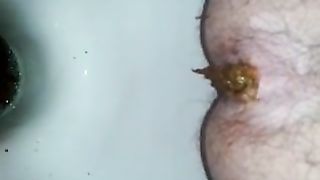 Hairy girl shitting