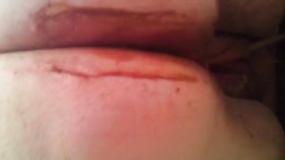 Very fat lady pooping