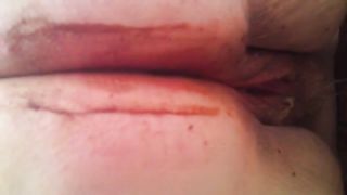 Very fat lady pooping