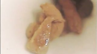 Hairy teen shitting over toilet