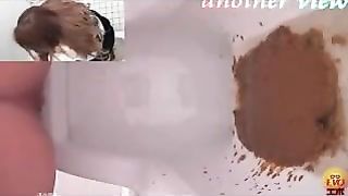 Japanese toilet diarheea