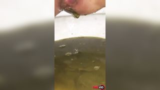 Diarheea with pressure for us