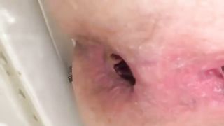 Teen shits on instagram