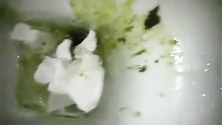 Lots of green diarheea