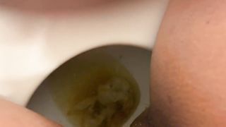 Enema aftermath in diapers