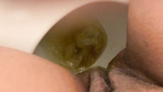 Enema aftermath in diapers