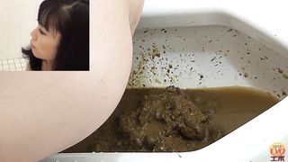 Japanese secretary has serious diarrhea