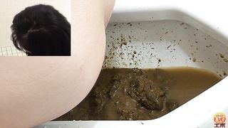 Japanese secretary has serious diarrhea