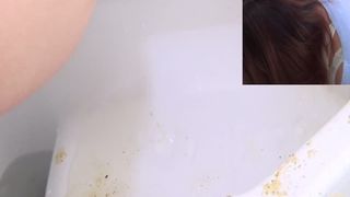 That moment when you really need to poop