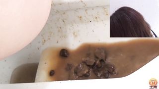 Diarrhea from japanese secretary