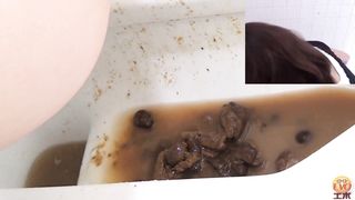 Diarrhea from japanese secretary