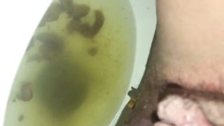 Hairy babe shitting over toilet