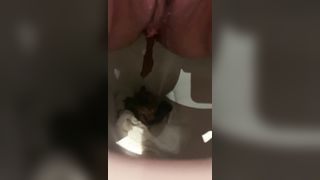 Close up of shaved teen shitting