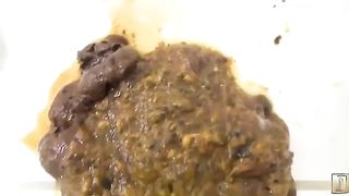 Japanese teen has big diarrhea