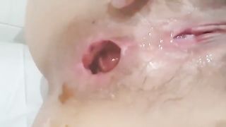 Close up of teen shitting a lot