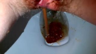 Teen on period shitting a lot