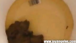 Urgency to poop in a bucket