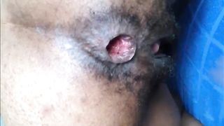 Hairy girl shitting an hard turd