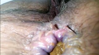 Hairy woman shitting very closeup