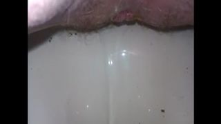 Hairy granny shitting closeup