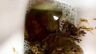 Hairy amateur lady pissing and pooping