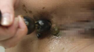 Teen Japanese chick anal beads her shitty hole