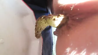 Search Results for Light skin girl shitting turd