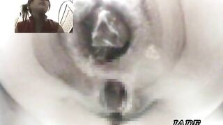 Amateur Asian lady poops in extreme closeup