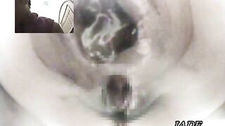 Amateur Asian lady poops in extreme closeup