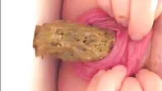 Prolapsed anus shitting closeup