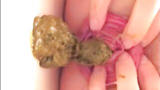 Prolapsed anus shitting closeup