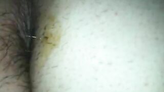 Sticky hairy asshole