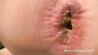 Gorgeous pooping asshole closeup
