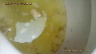 Pooping Diarrhea Show