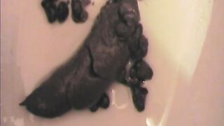 Dirty piss and heavy poop