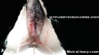 Bloody Piss And Shit Caught On Hidden Cam