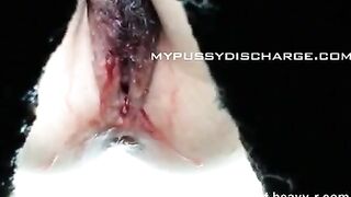 Bloody Piss And Shit Caught On Hidden Cam