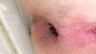 Beautiful juicy pooping asshole