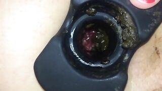 struggling with butt plug to poop