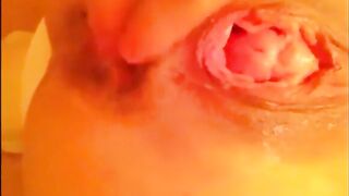 Anal self fisting prolapsed while shitting