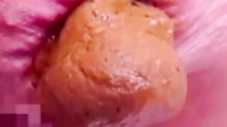 Constipated Hard Poop Solo